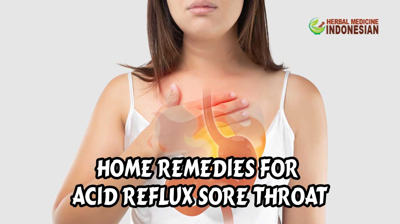 home remedies for acid reflux sore throat