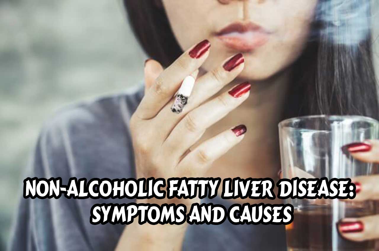 Non-Alcoholic Fatty Liver Disease