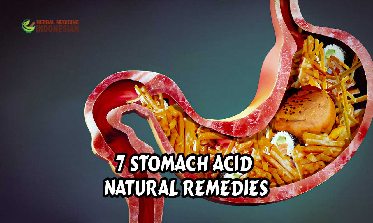 Stomach Acid Natural Remedies