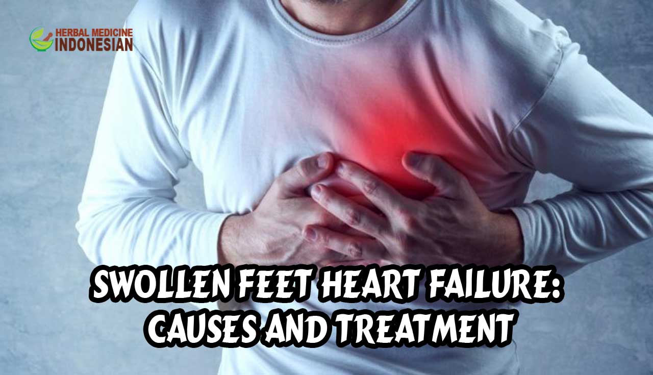 swollen feet heart failure