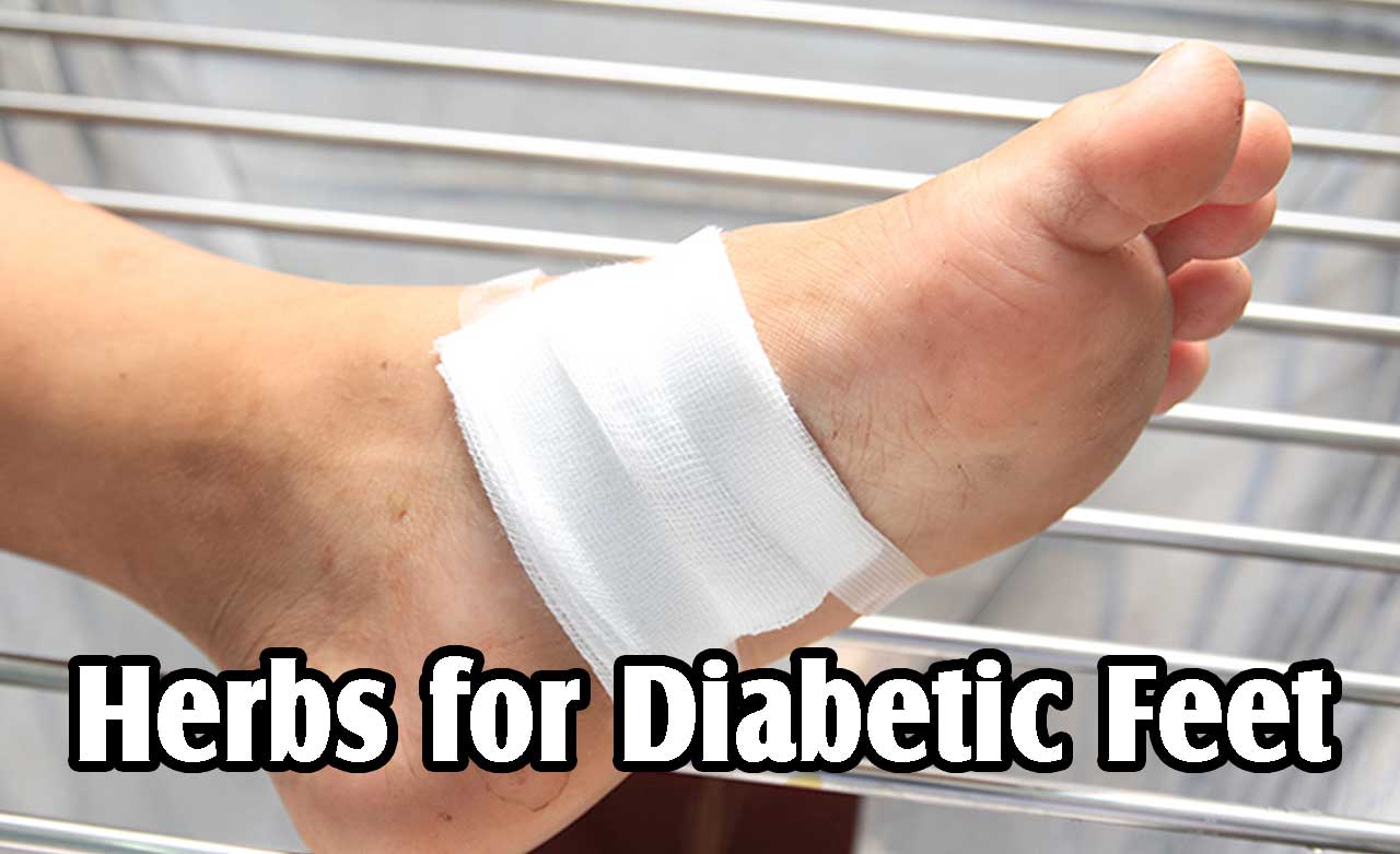 Herbs for Diabetic Feet