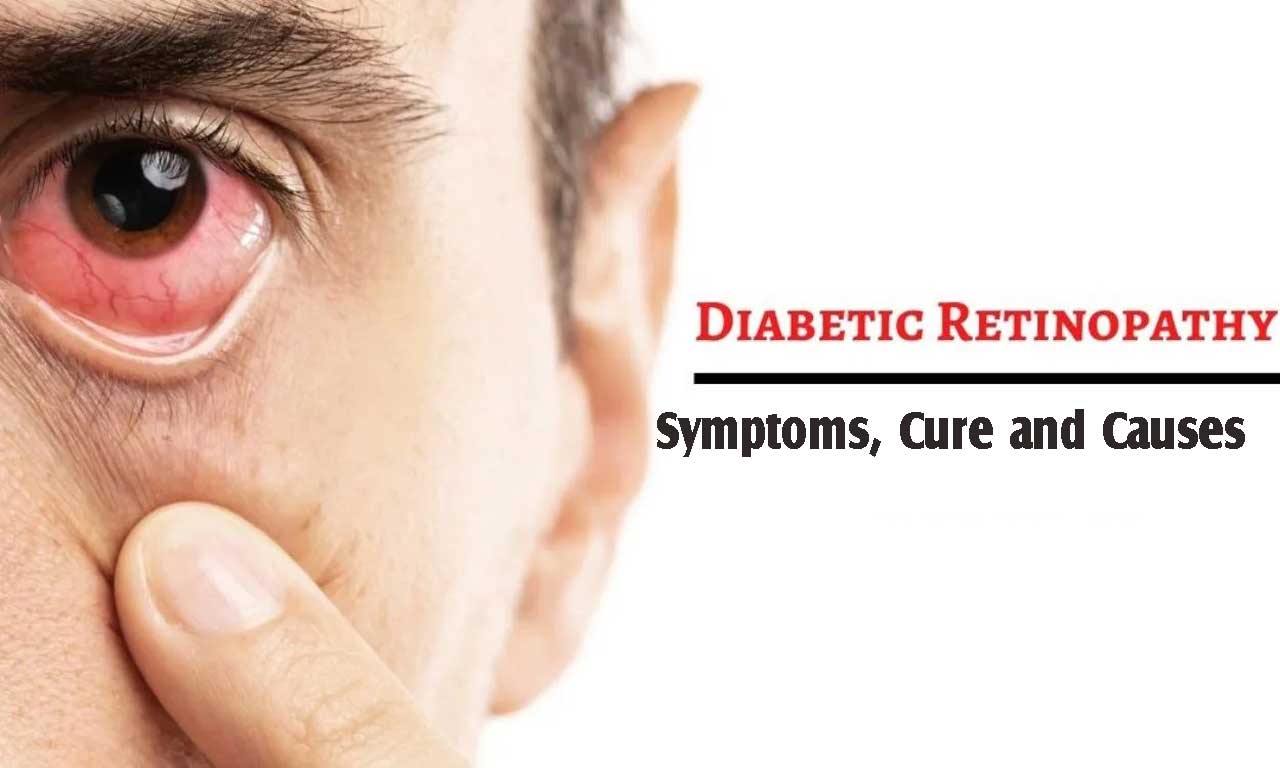 Diabetic retinopathy