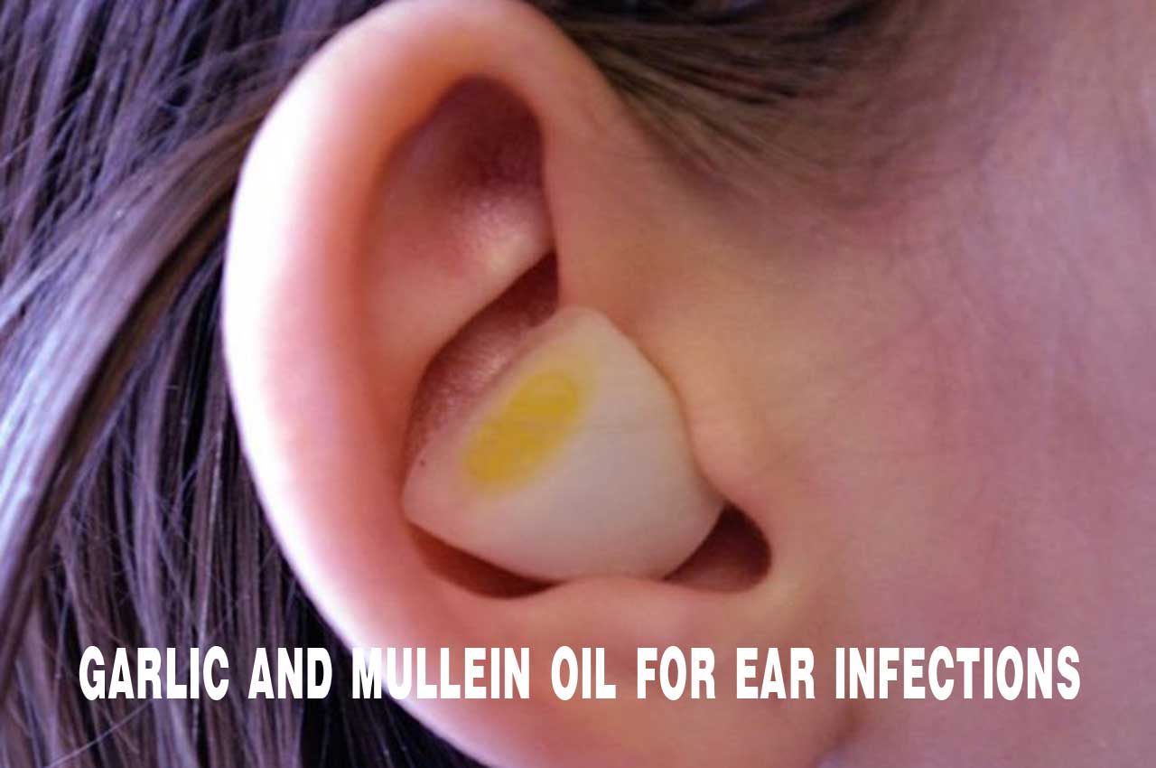 Garlic And Mullein Oil For Ear Infections