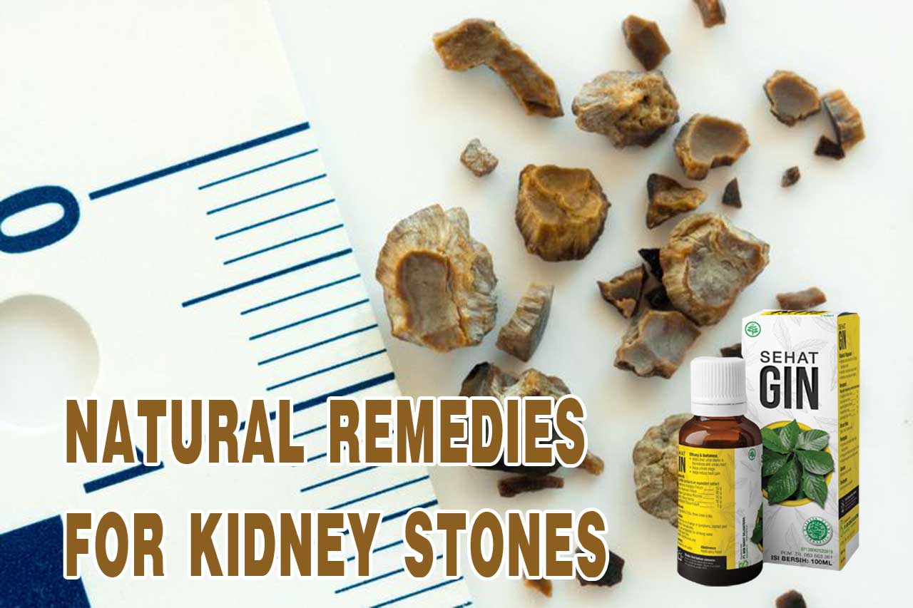 Natural Remedies for Kidney Stones